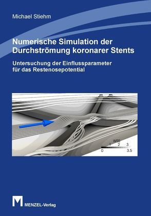 Numerische Simulation der Durchströmung koronarer Stents von Stiehm,  Michael