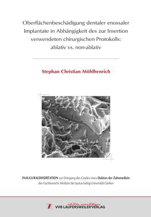 Oberflächenbeschädigung dentaler enossaler Implantate in Abhängigkeit des zur Insertion verwendeten chirurgischen Protokolls: ablativ vs. non-ablativ von Möhlhenrich,  Stephan Christian