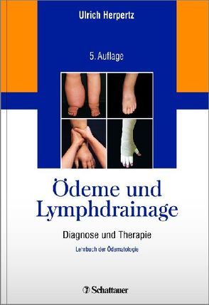 Ödeme und Lymphdrainage von Herpertz,  Ulrich