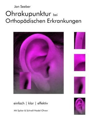 Ohrakupunktur bei Orthopädischen Erkrankungen von Seeber,  Jan