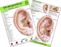 Ohrakupunktur – Indikation: akute Lumbalgie – chinesische Ohrakupunktur / Medizinische Taschen-Karte von Hawelka Verlag,  Hawelka