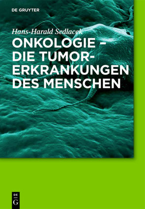 Onkologie – die Tumorerkrankungen des Menschen von Sedlacek,  Hans-Harald