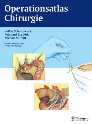 Operationsatlas Chirurgie von Kasperk,  Reinhard, Schumpelick,  Volker, Stumpf,  Michael