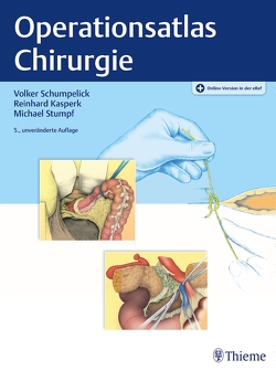 Operationsatlas Chirurgie von Kasperk,  Reinhard, Schumpelick,  Volker, Stumpf,  Michael