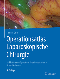 Operationsatlas Laparoskopische Chirurgie von Carus,  Thomas