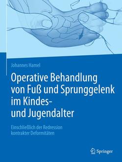 Operative Behandlung von Fuß und Sprunggelenk im Kindes- und Jugendalter von Hamel,  Johannes