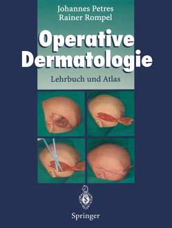 Operative Dermatologie von Darroll,  Robert, Petres,  Johannes, Rompel,  Rainer