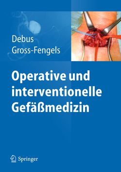 Operative und interventionelle Gefäßmedizin von Debus,  Eike Sebastian, Gross-Fengels,  Walter