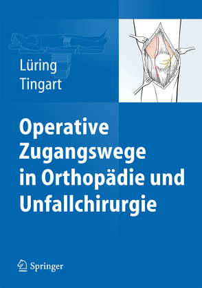 Operative Zugangswege in Orthopädie und Unfallchirurgie von Lüring,  Christian, Tingart,  Markus