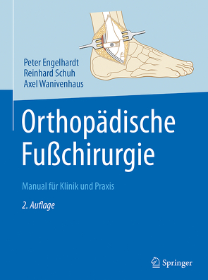 Orthopädische Fußchirurgie von Engelhardt,  Peter, Schuh,  Reinhard, Wanivenhaus,  Axel