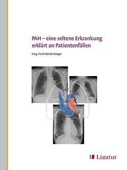 PAH – eine seltene Erkrankung erklärt an Patientenfällen von Frank,  Reichenberger