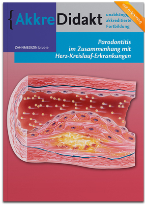 Parodontitis im Zusammenhang mit Herz-Kreislauf-Erkrankungen von Loos,  Bruno