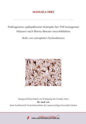 Pathogenese epileptiformer Krämpfe bei TNF-transgenen Mäusen nach Borna disease virus-Infektion: von Hirz,  Manuela