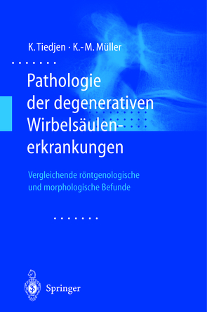 Pathologie der degenerativen Wirbelsäulenerkrankungen von Müller,  Klaus-Michael, Tiedjen,  Kay