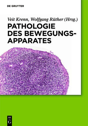 Pathologie des Bewegungsapparates von Krenn,  Veit, Ruether,  Wolfgang