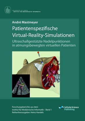 Patientenspezifische Virtual-Reality-Simulationen von Mastmeyer,  André