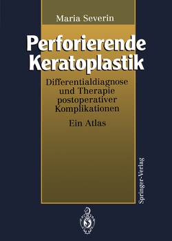 Perforierende Keratoplastik von Severin,  Maria