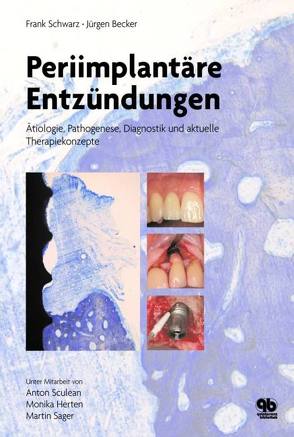 Periimplantäre Entzündungen von Becker Jürgen, Herten,  Monika, Sager,  Martin, Schwarz,  Frank, Sculean,  Anton