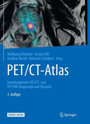 PET/CT-Atlas von Hertel,  Andreas, Hör,  Gustav, Mohnike,  Wolfgang, Schelbert,  Heinrich