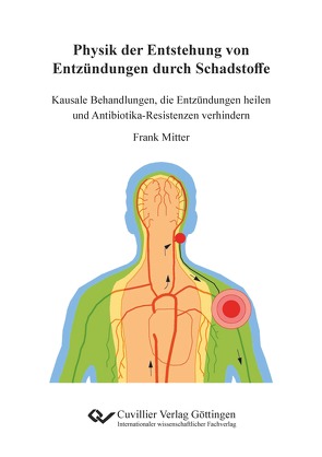 Physik der Entstehung von Entzündungen durch Schadstoffe in der Nahrung, in den Zahnfleischtaschen und von schädlichen Bakterien am Beispiel der rheumatoiden Arthritis von Mitter,  Frank