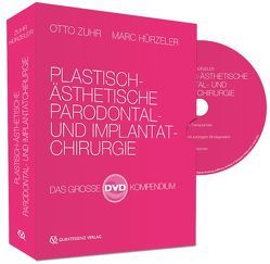 Plastisch-ästhetische Parodontal- und Implantatchirurgie von Hürzeler,  Marc, Zuhr,  Otto