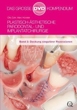 Plastisch-Ästhetische Parodontal- und Implantatchirurgie / Plastisch-Ästhetische Parodontal- und Implantatchirurgie von Hürzeler,  Marc, Zuhr,  Otto