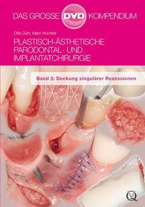 Plastisch-Ästhetische Parodontal- und Implantatchirurgie / Plastisch-Ästhetische Parodontal- und Implantatchirurgie von Hürzeler,  Marc, Zuhr,  Otto