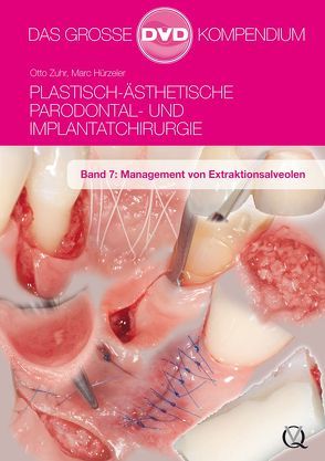 Plastisch-Ästhetische Parodontal- und Implantatchirurgie von Hürzeler,  Marc, Zuhr,  Otto