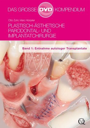 Plastisch-Ästhetische Parodontal- und Implantatchirurgie von Hürzeler,  Marc, Zuhr,  Otto