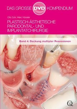 Plastisch-Ästhetische Parodontal- und Implantatchirurgie von Hürzeler,  Marc, Zuhr,  Otto