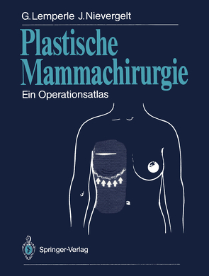 Plastische Mammachirurgie von Lemperle,  Gottfried, Nievergelt,  Jürg, Strömbeck,  J.O.