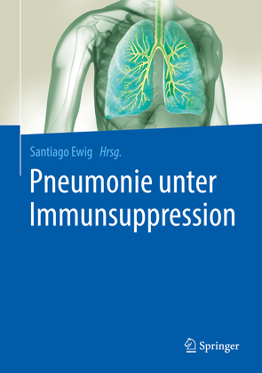 Pneumonie unter Immunsuppression von Ewig,  Santiago