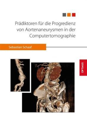 Prädiktoren für die Progredienz von Aortenaneurysmen in der Computertomographie von Schaaf,  Sebastian