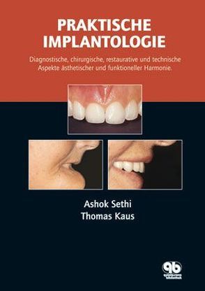 Praktische Implantologie von Kaus,  Thomas, Sethi,  Ashok