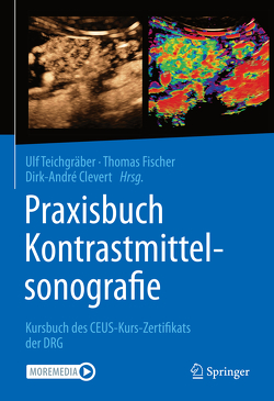 Praxisbuch Kontrastmittelsonografie von Clevert,  Dirk-André, Fischer,  Thomas, Teichgräber,  Ulf