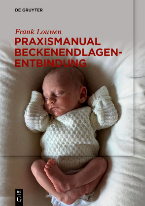 Praxismanual Beckenendlagenentbindung von Louwen,  Frank