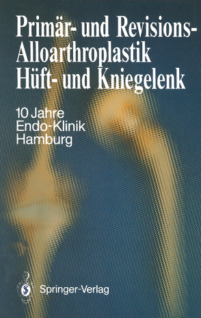 Primär- und Revisions-Alloarthroplastik Hüft- und Kniegelenk von Endo-Klinik