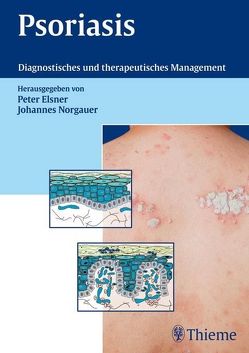 Psoriasis von Bauer,  Andrea, Boehncke,  Wolf-Henning, Elsner,  Peter Ulrich, Goetze,  Steven, Norgauer,  Johannes