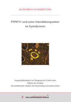 PTPIP51 und seine Interaktionspartner im Ependymom von Schmidtchen,  Katharina