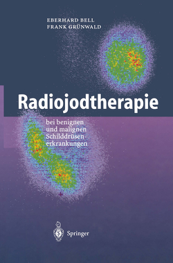 Radiojodtherapie von Bell,  Eberhard, Grünwald,  Frank