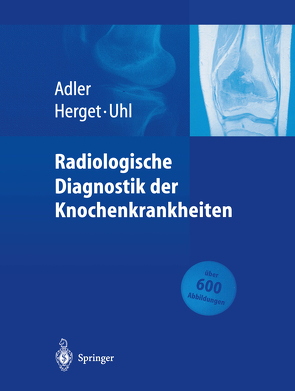 Radiologische Diagnostik der Knochenkrankheiten von Adler,  Claus-Peter, Herget,  Georg, Uhl,  Markus, Zajic,  T.