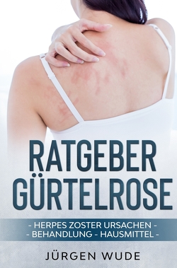 Ratgeber Gürtelrose von Wude,  Jürgen