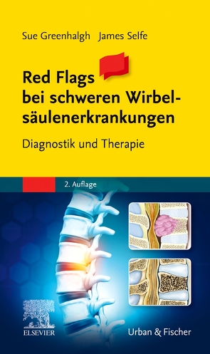 Red Flags bei schweren Wirbelsäulenerkrankungen von Greenhalgh,  Sue, Selfe,  James, Simader,  Rainer