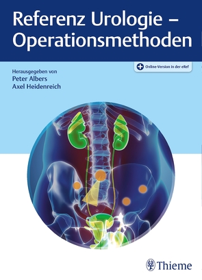 Referenz Urologie – Operationsmethoden von Albers,  Peter, Heidenreich,  Axel