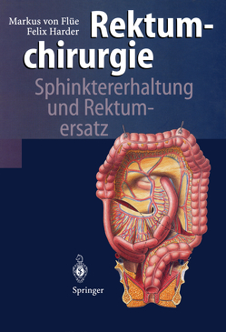 Rektumchirurgie von Beglinger,  C., Degen,  L., Flüe,  Markus von, Harder,  Felix, Herfarth,  C., Herrmann,  R., Imholz,  T., Landmann,  C.