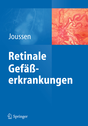 Retinale Gefäßerkrankungen von Joussen,  Antonia