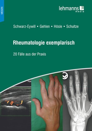 Rheumatologie exemplarisch von Gehlen,  Martin, Hösle,  Rosmarie, Schultze,  Mareen, Schwarz-Eywill,  Michael