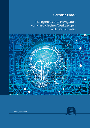 Röntgenbasierte Navigation von chirurgischen Werkzeugen in der Orthopädie von Brack,  Christian