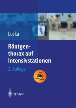 Röntgenthorax auf Intensivstationen von Boetticher,  Heiner, Kuckelt,  W., Luska,  Günter, Saßen,  R., Schwarze,  L.