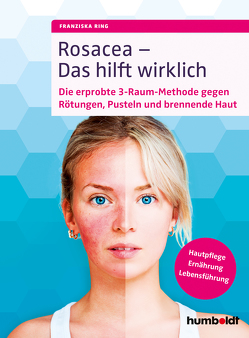 Rosacea – Das hilft wirklich von Ring,  Franziska